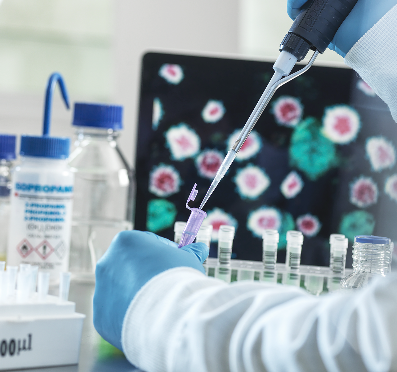 김욱·최상돈 교수팀, 자가면역질환 치료 위한 新 화합물 개발