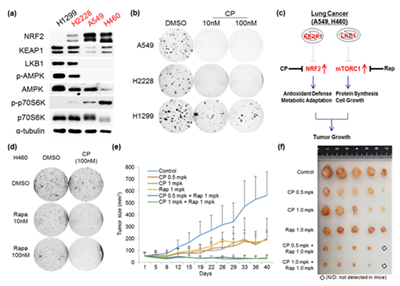 [17.6.9] Ajou University Professor Sang Min Jeon discovers a substance that can help treat lung cancer